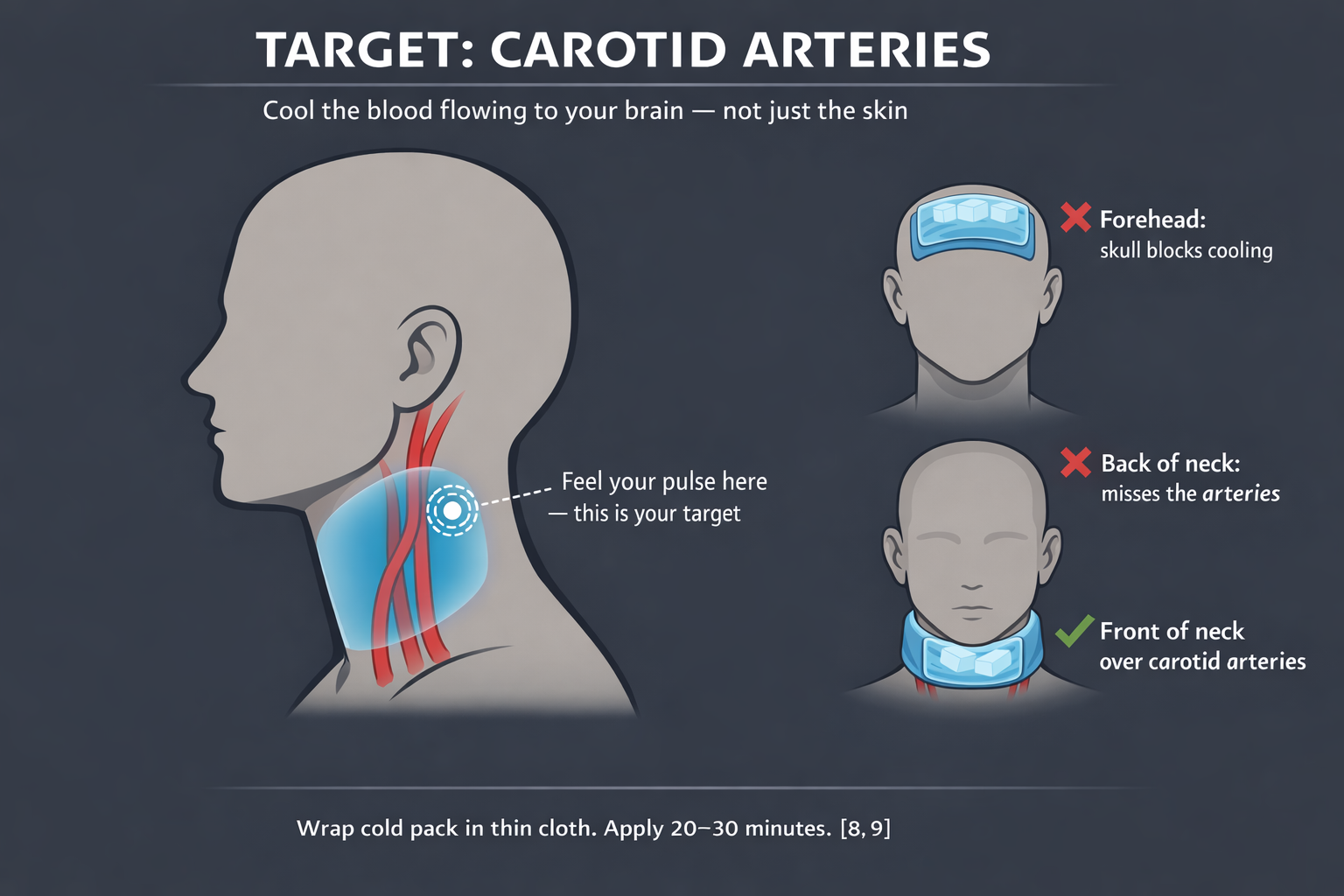 Target: Carotid Arteries — correct cold pack placement on front of neck for migraine relief